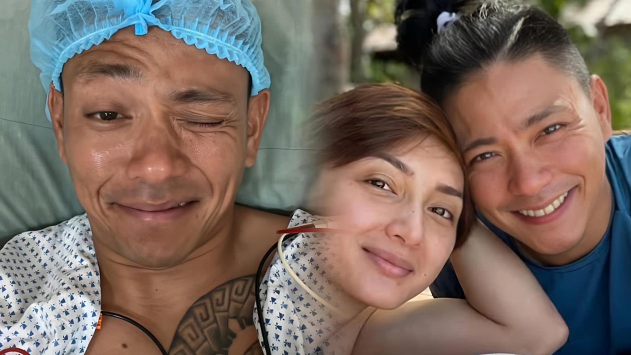 Drew Arellano, sumailalim sa vasectomy procedure